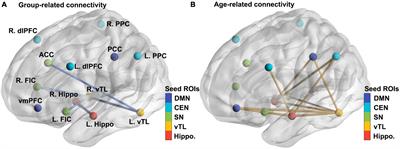 Age-related differences in the intrinsic connectivity of the hippocampus and ventral temporal lobe in autistic individuals